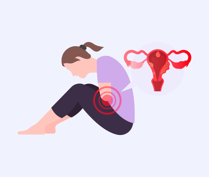 endometriosis specialist Dubai