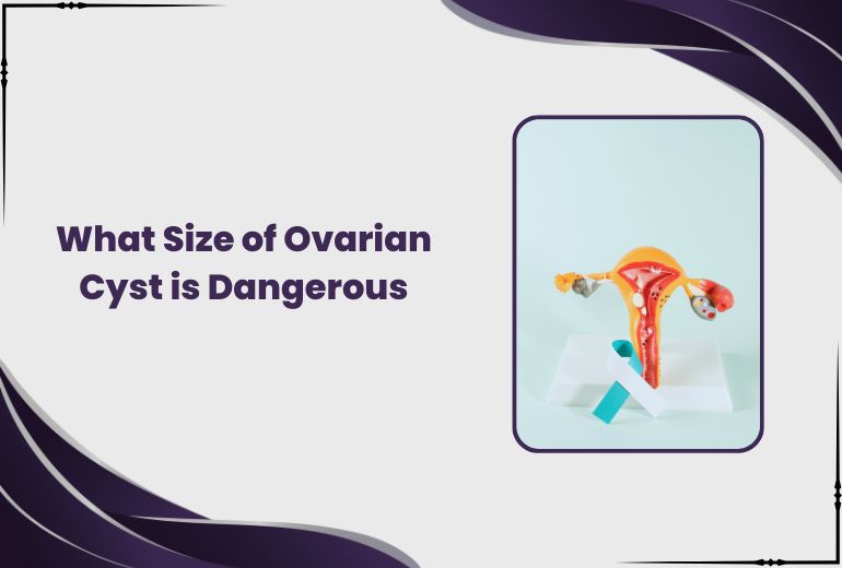 What size of ovarian cyst is dangerous