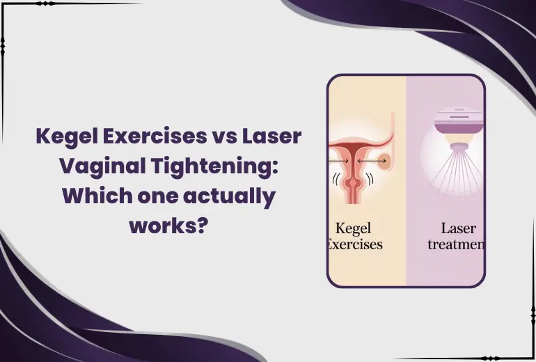 kegel exercises vs laser vaginal tightening comparison effectiveness results